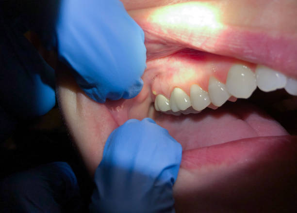 Best Emergency Dental Services for Seniors in Brewton, AL